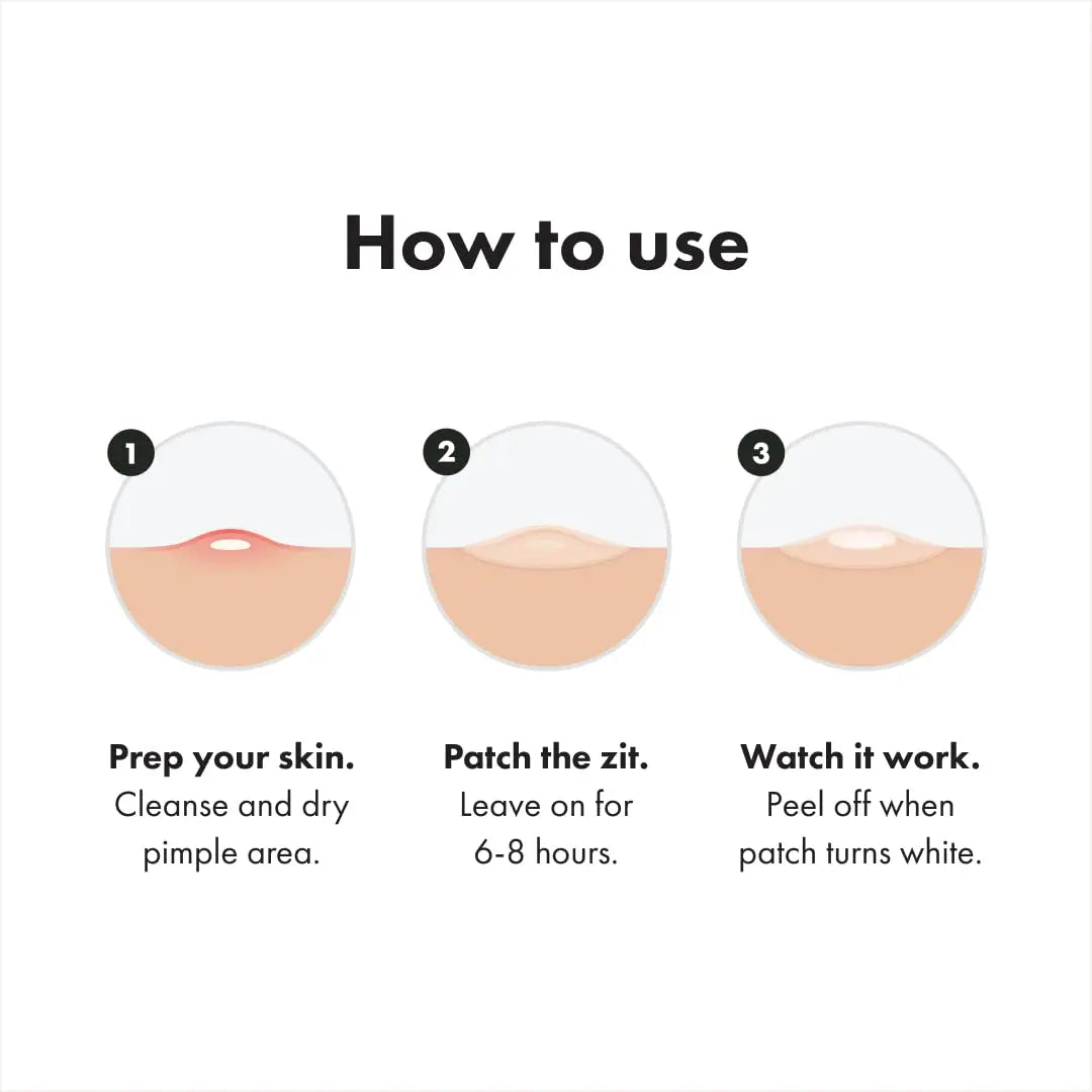 Mighty Patch™ Original Patch from Hero Cosmetics – The #1 Hydrocolloid Acne Pimple Patch for Covering Zits and Whiteheads in 1 use; Nighttime Spot Stickers for Face and Skin (36 Count)